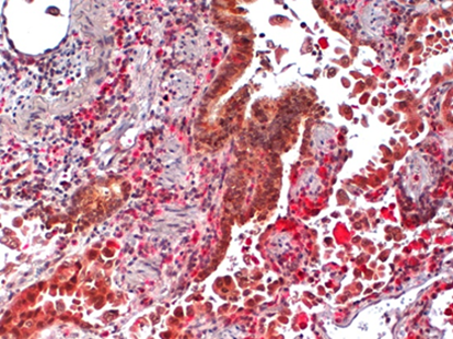 IHC Antibody Validation by Labospace