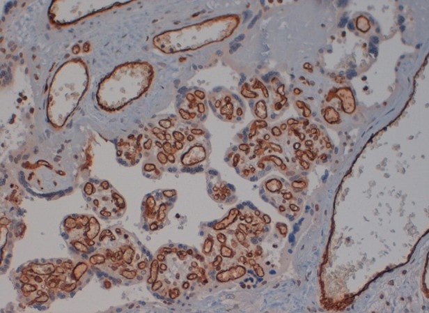 IHC Validation Service by Labospace