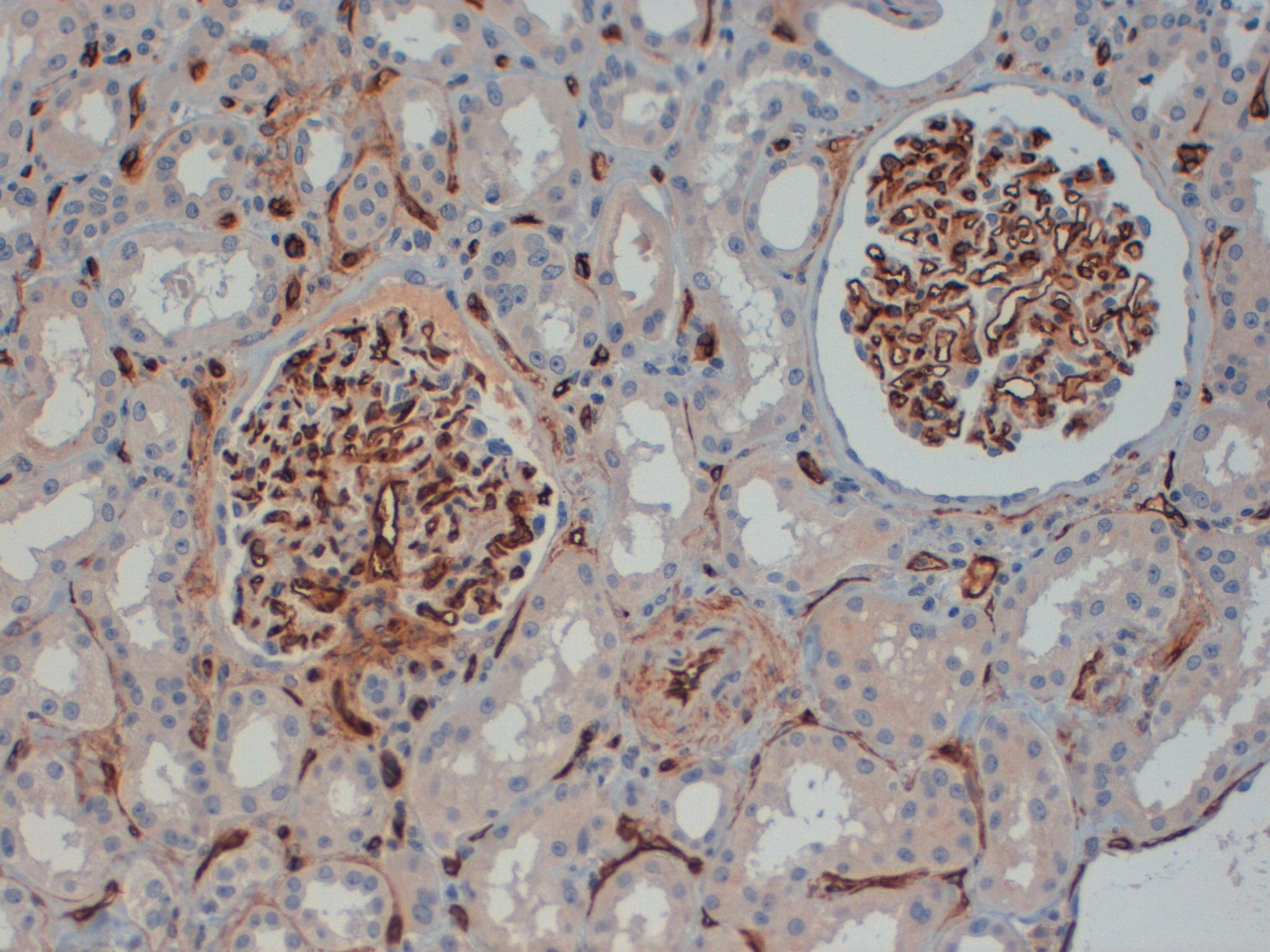 CD34 Kidney 40x