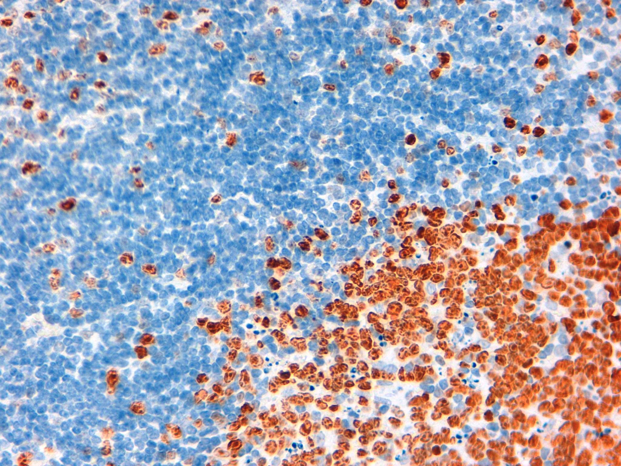 KI67 Mouse Colon 20X