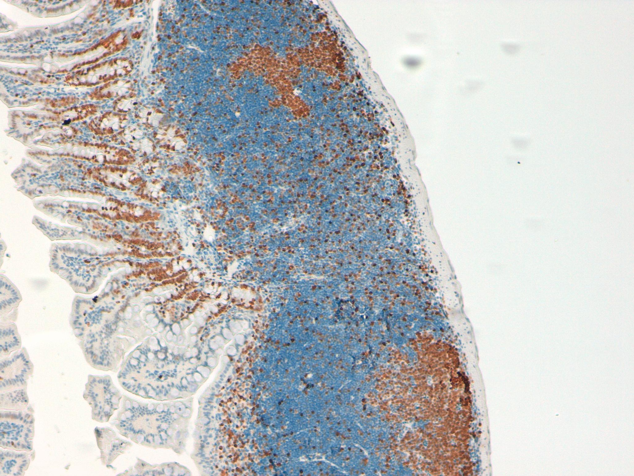KI67 Mouse Intestine 10X