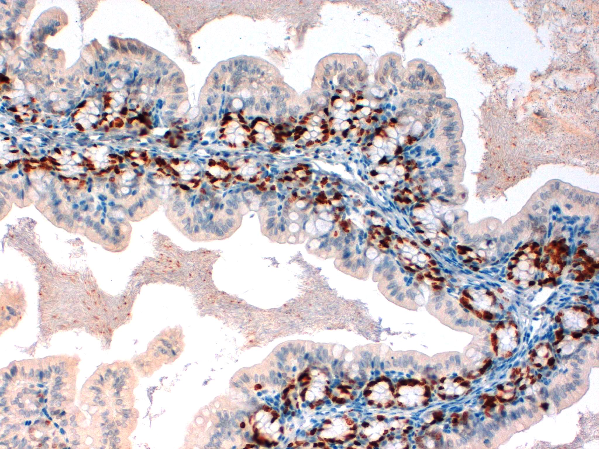 KI67 Mouse Intestine 20X