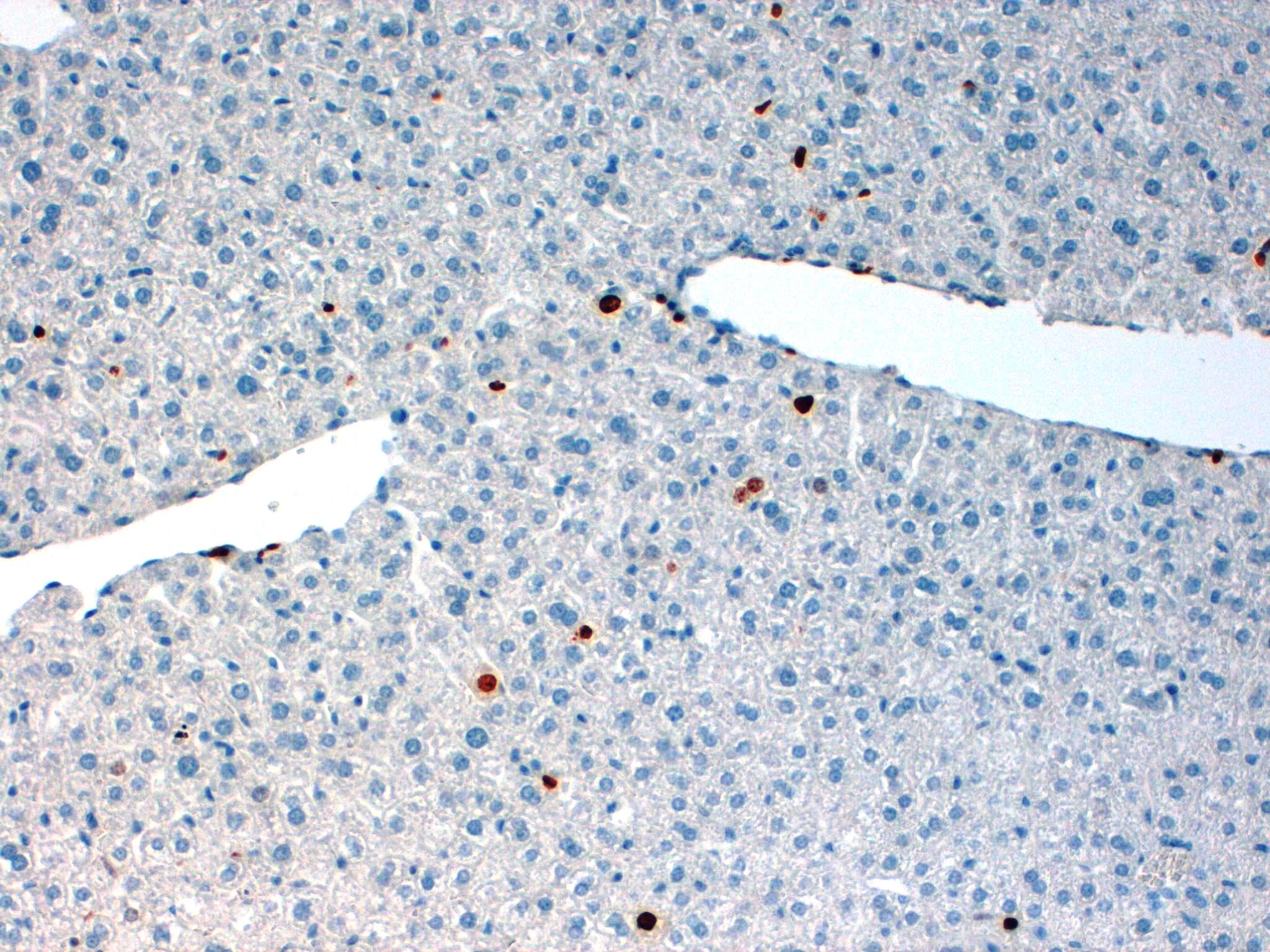 KI67 Mouse Liver 20X