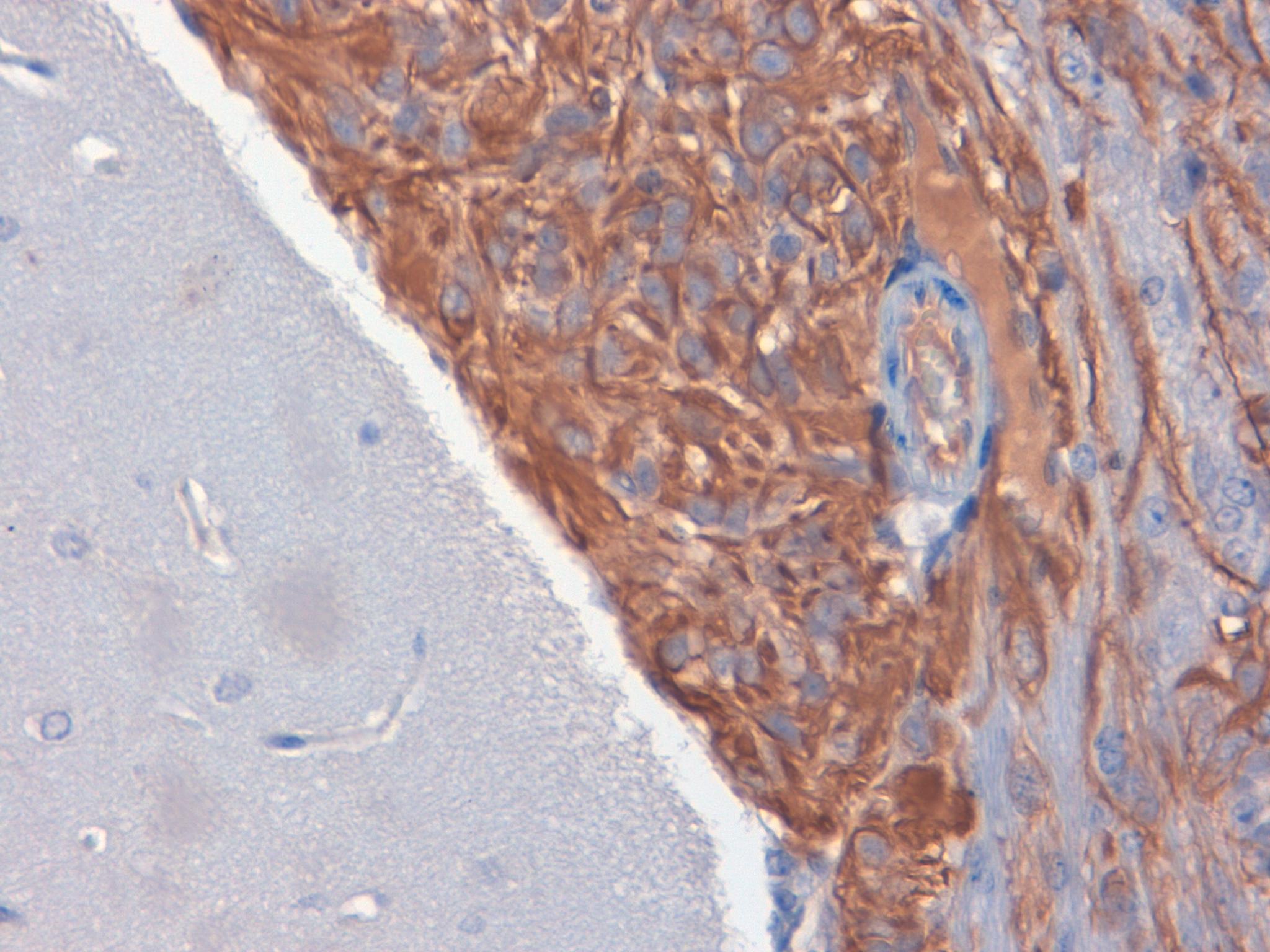 Nestin Nervous Xenograft 40X