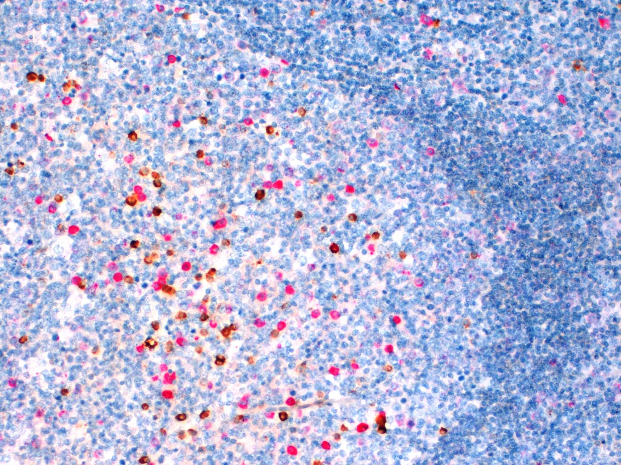 Kappa Lambda Double Staining 20x