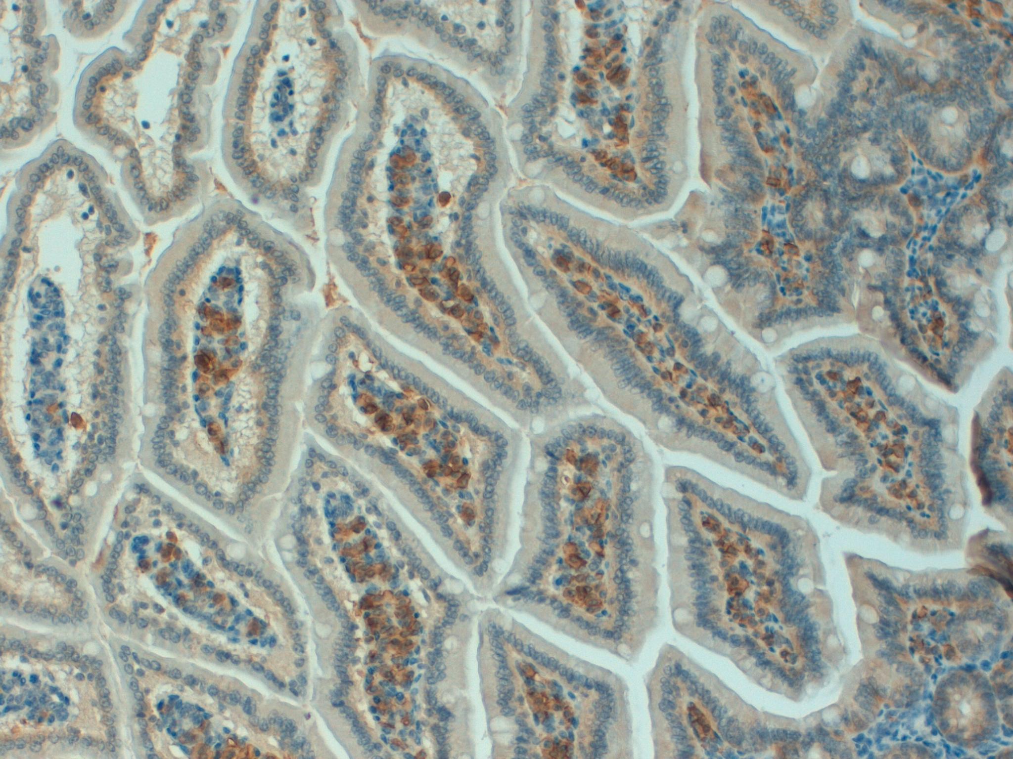 Mouse Colon 20x CD138