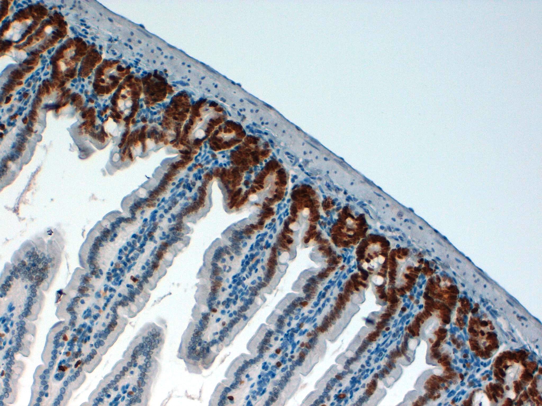 Mouse Colon 20x ki67