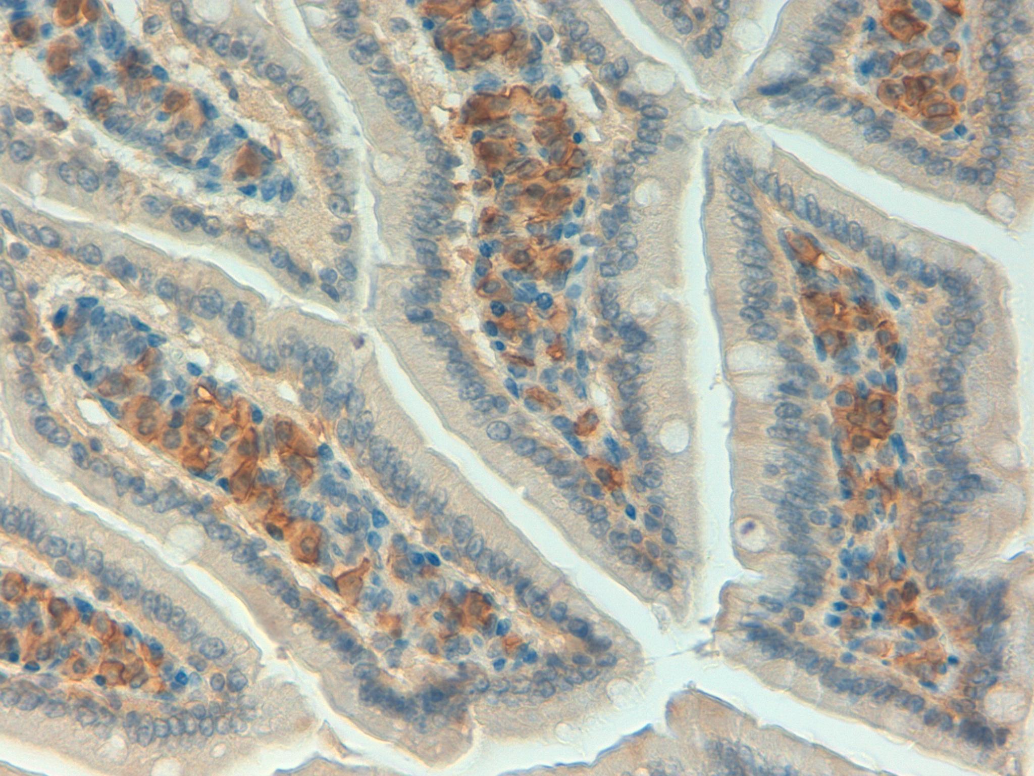 Mouse Colon 40x CD138