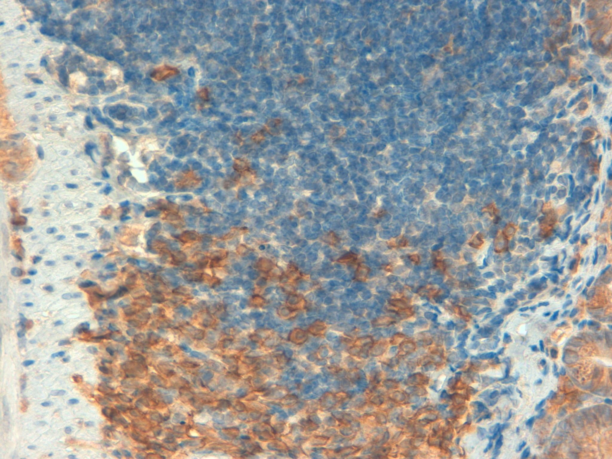 Mouse colon 40x CD138