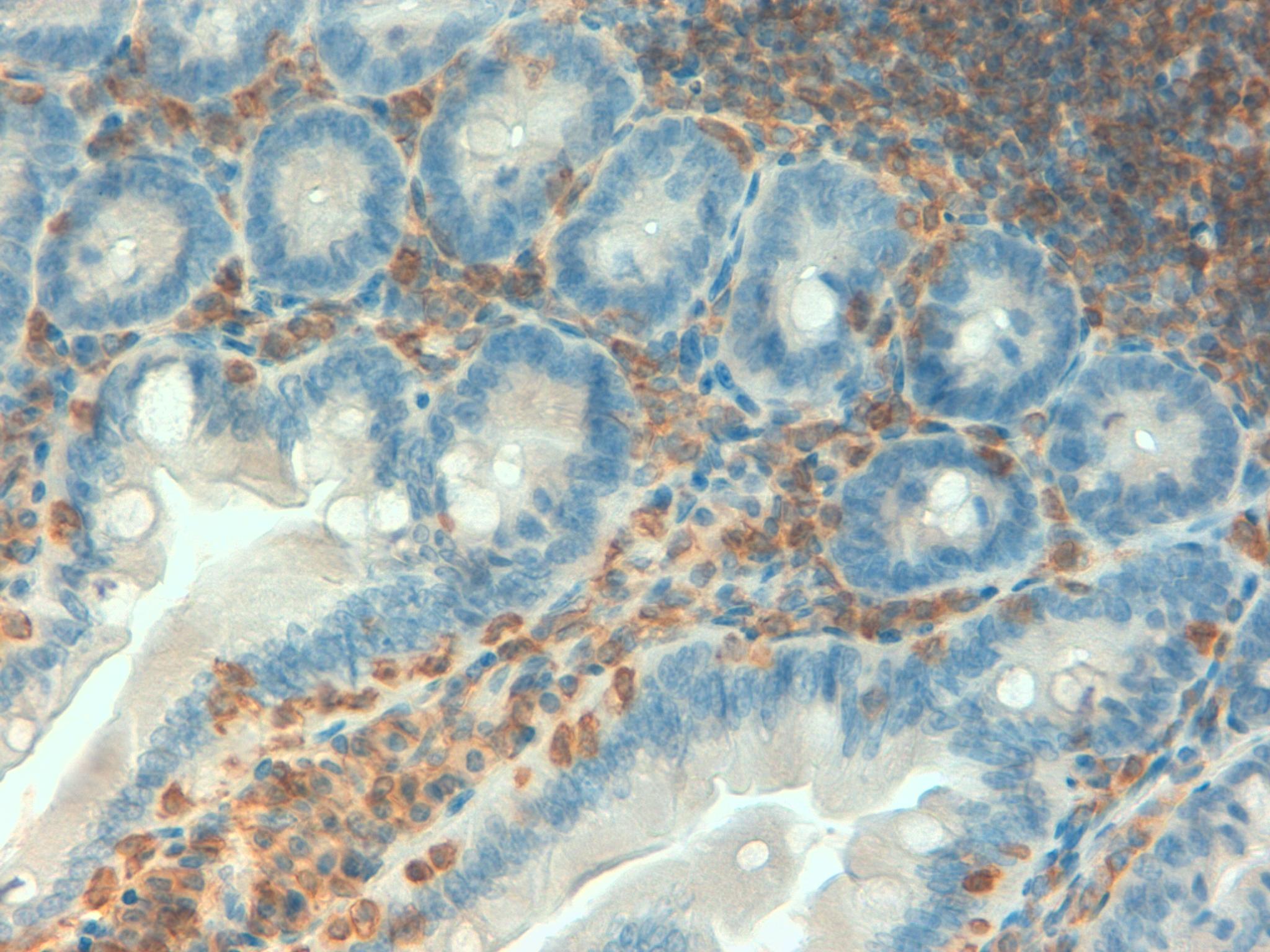 Mouse Colon 40x CD45